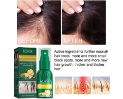 Gember Haargroei Serum - Duo Verpakking - Gember Haar Spray voor Haargoei - Vollere Bos Haren - Anti Kaalheid - Haar Wordt Dikker - Ginger Hairspray - Ga Dunner Wordend Haar Tegen - Betere Baardgroei — cadeau in Cadeau-ideeën