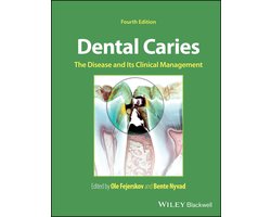 Dental Caries — cadeau in Cadeau-ideeën