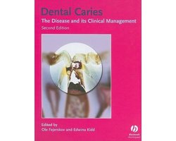 Dental Caries — cadeau in Cadeau-ideeën